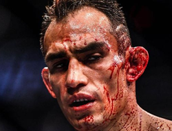 фото - Ломаченко с двуликим Усиком, Папин готов провести бесплатный реванш, кровавый Фергюсон — соцсети 