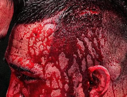 фото - Не для слабонервных. Рафа Гарсия потерял 20 процентов крови в прошедшем бою