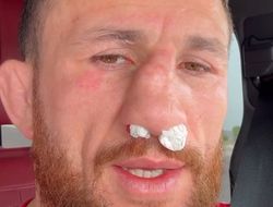 фото - Бой Ян – Двалишвили 3 на грани срыва? Мераб травмировал нос