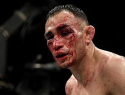 фото - У Тони Фергюсона перелом, но он танцует с капельницей: видео