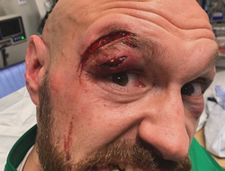 фото - У Фьюри могут возникнуть проблемы в бою с Усиком. Объясняет эксперт