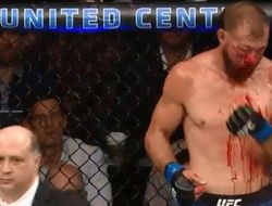 фото - UFC 238. Деды недовоевали: Серроне измочалили лицо, Фергюсону — досрочка в актив