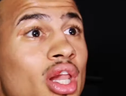 фото - Ромеро: «Танк Дэвис? У Барросо удар в миллион раз сильнее»