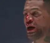 Экс-чемпиона Bellator избили в главном событии шоу Rizin