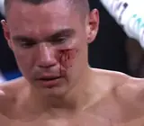 Окровавленный Цзю побил Нурью: видео