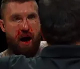 Звезда метал-сцены провалил дебют в BKFC: видео