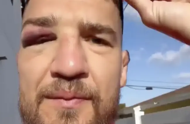 Амосов получил травму за несколько дней до боя на UFC 328
